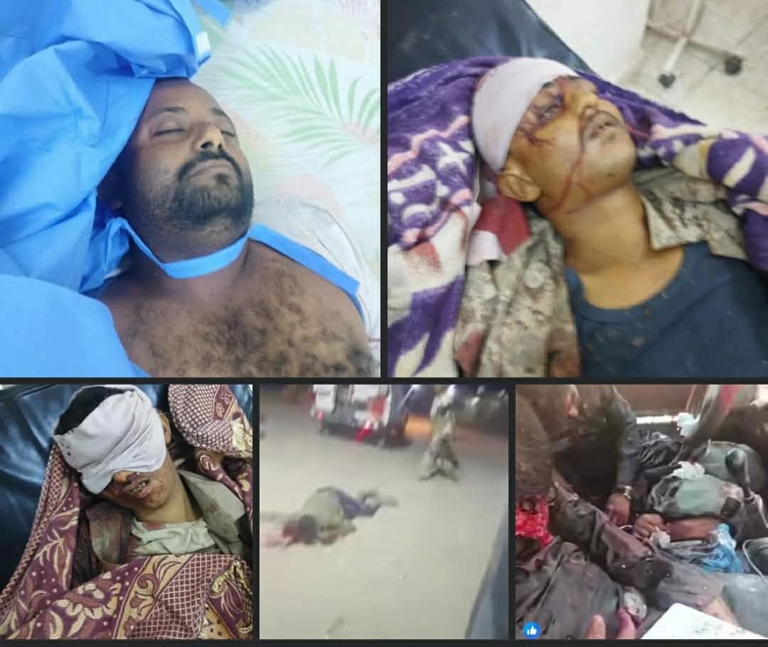 موقف لا أخلاقي.. وزارتا الدفاع والداخلية ومحافظ حضرموت يتجاهلون سقوط 6 شهداء جنوبيين في معسكر رماه